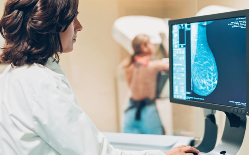 A importncia de realizar a mamografia anualmente 