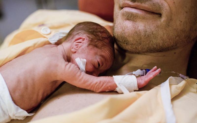  Novembro Roxo: Hospital Imigrantes chama ateno para a Prematuridade